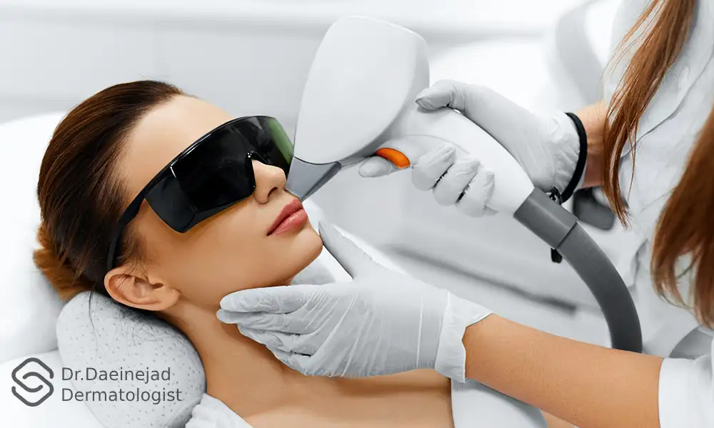 سفید شدن مو بعد از لیزر موهای صورت