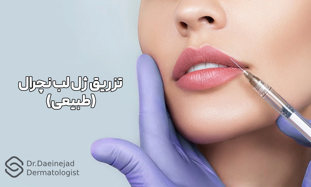 عکس تزریق ژل لب نچرال
