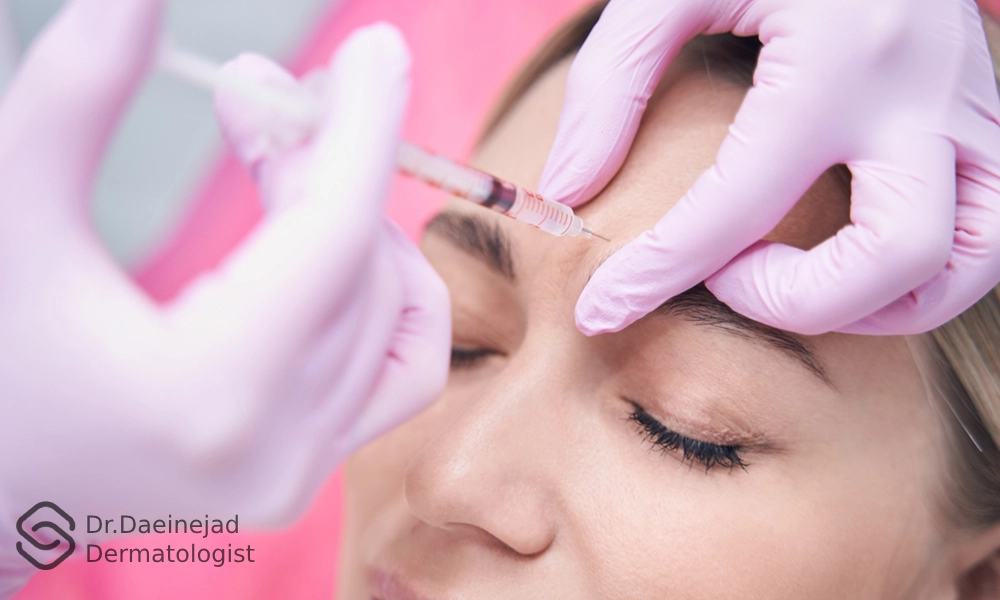 مشخص کردن و تزریق ژل خط اخم برا یک خانم