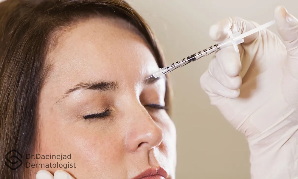انجام تزریق ژل خط اخم برای یک خانم که چشمان خود را بسته است.